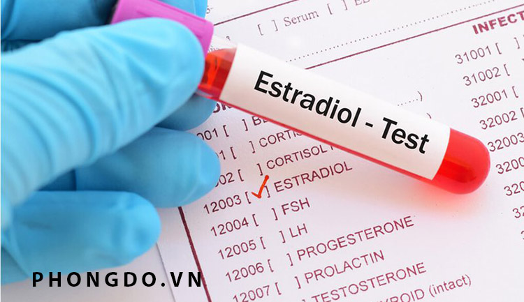 Xét nghiệm chỉ số Estradiol