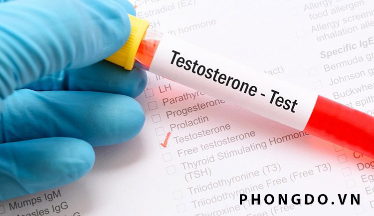 Xét nghiệm Testosterone